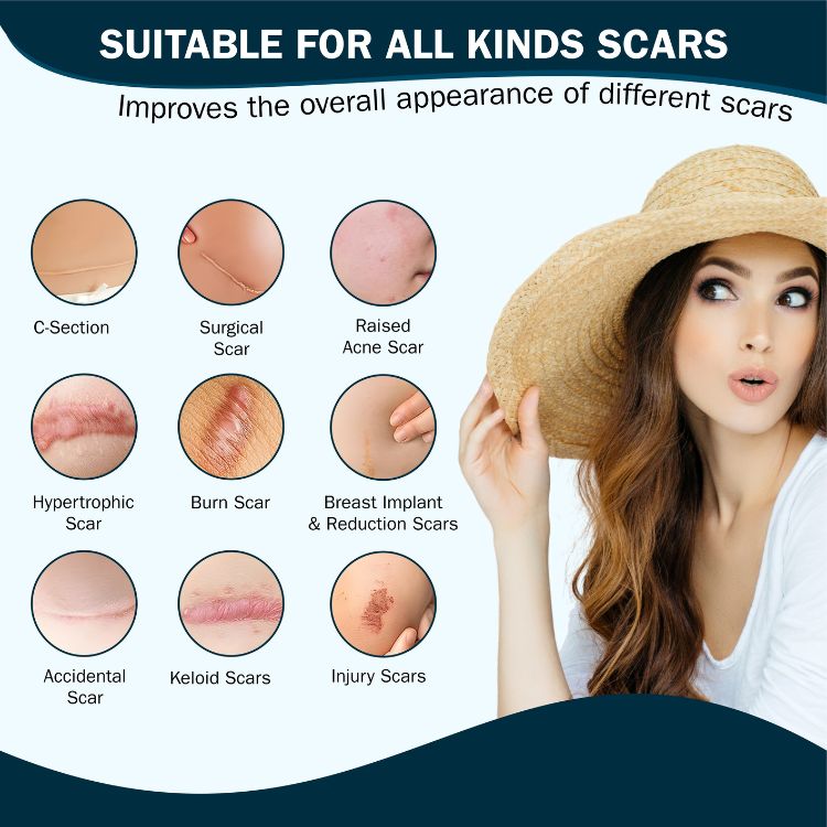 Silicone Scar Cream