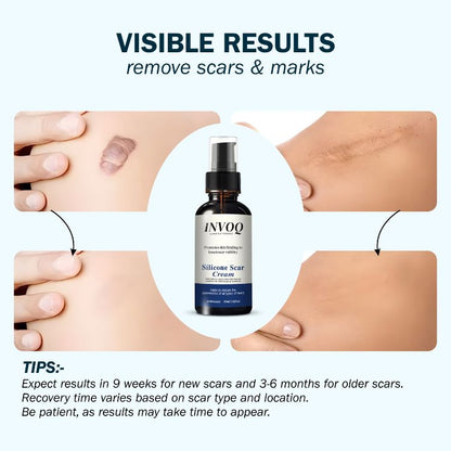 Silicone Scar Cream